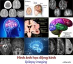 Hinh anh hoc dong kinh e1549033111150