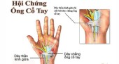 cổ tay