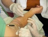 KT tiêm botulinum toxinA